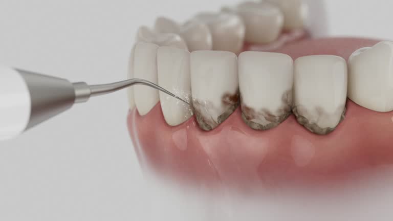 Trusted Tooth Extraction service in Rantoul, IL - Dentist Open Now